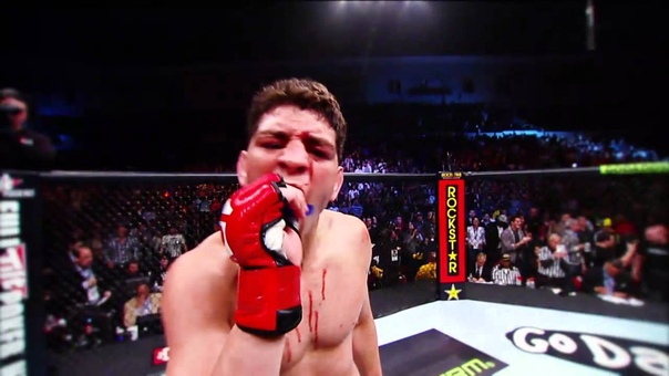 NICK DIAZ vs CARLOS