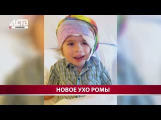 Четырёхлетнему сахалинцу в США имплантировали ушко