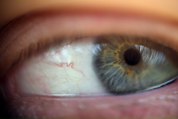 №11, Роман Заблоцкий, Кривой Рог №11, Роман Заблоцкий, Кривой Рог